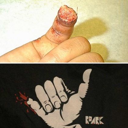 ZERBROCHENER SCHAKA!